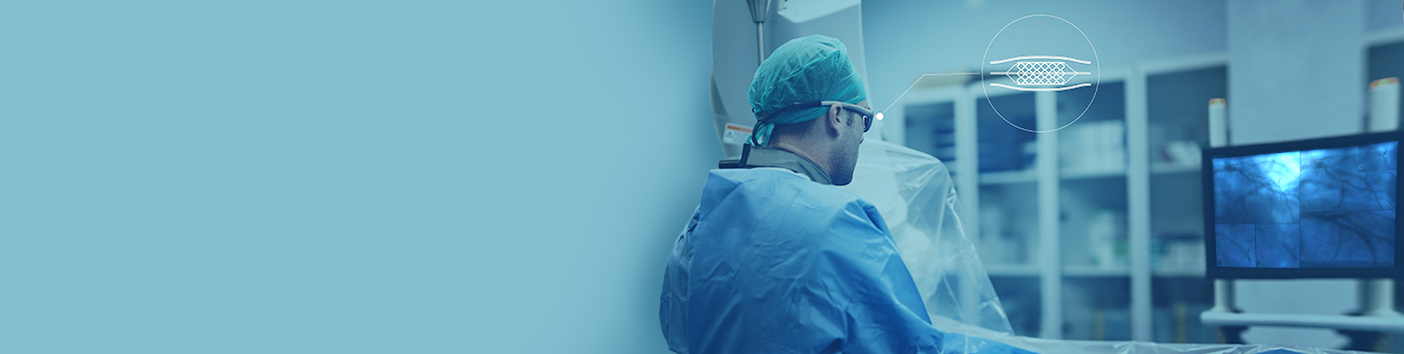 Angiography