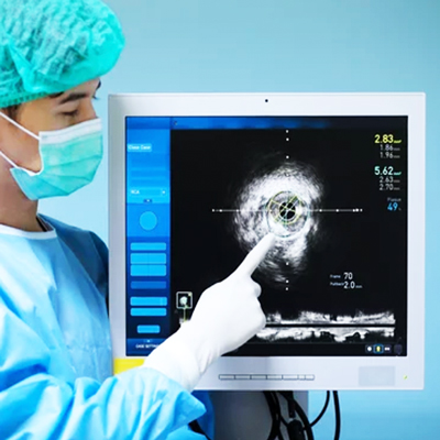 Role of IVUS in Totally Occluded Vessels