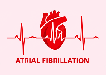 Atrial Fibrillation