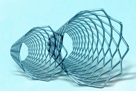 When Does A Person Require a Heart Stent?