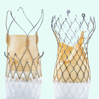 Transcatheter Aortic Valve Replacement (TAVR)