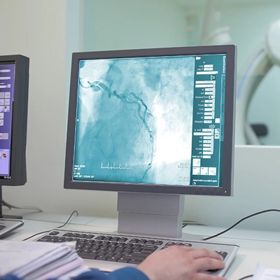 Understanding Angiography