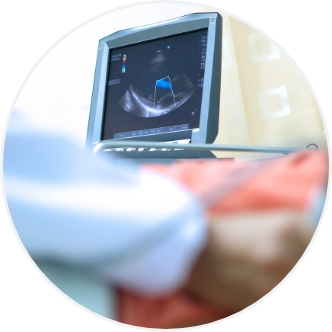 2D Echocardiography