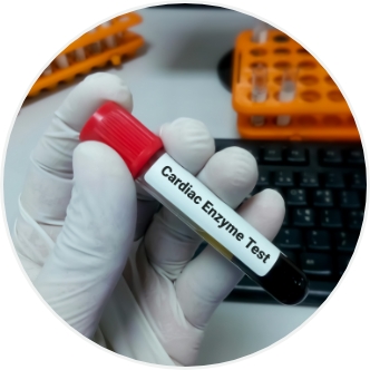 Cardiac Enzymes