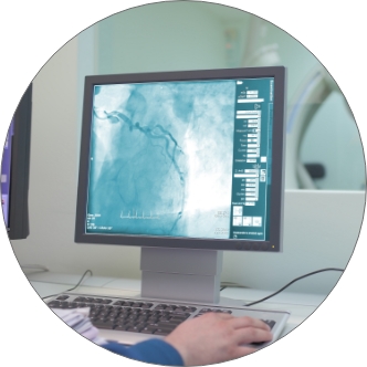 Coronary Angiography