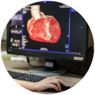 CT Coronary Angiography